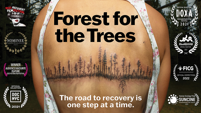FOREST FOR THE TREES